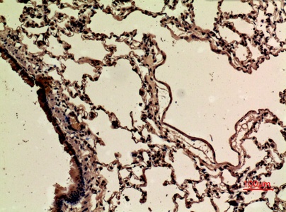 Fig.4. Immunohistochemical analysis of paraffin-embedded rat-lung, antibody was diluted at 1:100.
