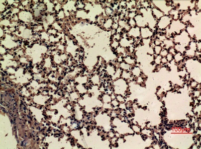 Fig.5. Immunohistochemical analysis of paraffin-embedded mouse-lung, antibody was diluted at 1:100.