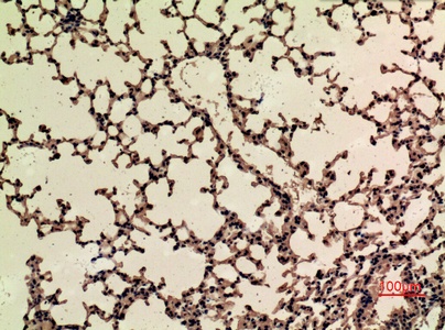 Fig.6. Immunohistochemical analysis of paraffin-embedded mouse-lung, antibody was diluted at 1:100.