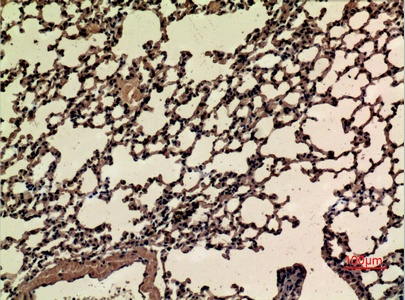 Fig.7. Immunohistochemical analysis of paraffin-embedded mouse-lung, antibody was diluted at 1:100.