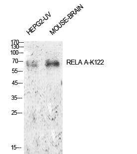 Fig.1. Western Blot analysis of HepG2-UV, mouse brain cells using Acetyl-NFκB-p65 (K122) Polyclonal Antibody. Antibody was diluted at 1:1000. Secondary Antibody  was diluted at 1:20000.