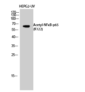 Fig.2. Western Blot analysis of HEPG2-UV cells using Acetyl-NFκB-p65 (K122) Polyclonal Antibody diluted at 1:1000. Secondary Antibody  was diluted at 1:20000.