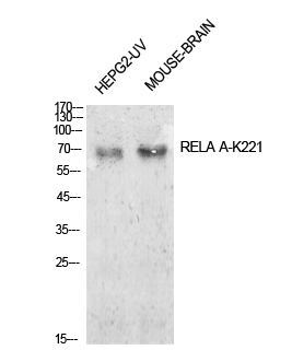 Fig.1. Western Blot analysis of HepG2-UV, mouse brain cells using Acetyl-NFκB-p65 (K221) Polyclonal Antibody. Antibody was diluted at 1:1000. Secondary Antibody  was diluted at 1:20000.