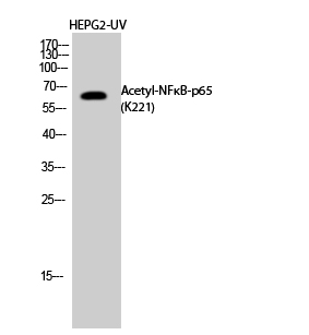 Fig.2. Western Blot analysis of HEPG2-UV cells using Acetyl-NFκB-p65 (K221) Polyclonal Antibody diluted at 1:1000. Secondary Antibody  was diluted at 1:20000.