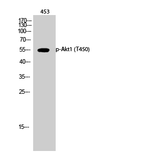Fig.2. Western Blot analysis of 453 cells using Phospho-Akt1 (T450) Polyclonal Antibody diluted at 1:1000.