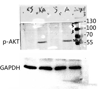 Fig.4. Western blot analysis of various lysis using Phospho-Akt1 (T450) Polyclonal Antibody diluted at 1:1000. Secondary antibody was diluted at 1:20000.
