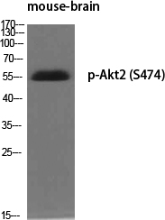 Fig.1. Western Blot analysis of various cells using Phospho-Akt2 (S474) Polyclonal Antibody diluted at 1:500