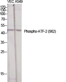 Fig.1. Western Blot analysis of various cells using Phospho-ATF-2 (S62) Polyclonal Antibody diluted at 1:1000.