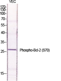 Fig.1. Western Blot analysis of various cells using Phospho-Bcl-2 (S70) Polyclonal Antibody diluted at 1:1000.