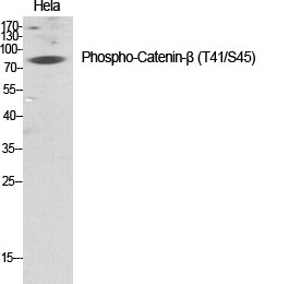 Fig.1. Western Blot analysis of various cells using Phospho-Catenin-β (T41/S45) Polyclonal Antibody diluted at 1:1000.