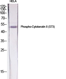 Fig.1. Western Blot analysis of various cells using Phospho-Cytokeratin 8 (S73) Polyclonal Antibody diluted at 1:500.