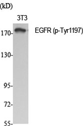 Fig.1. Western Blot analysis of various cells using Phospho-EGFR (Y1197) Polyclonal Antibody diluted at 1:1000.