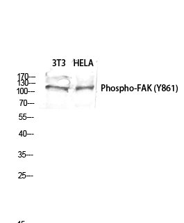 Fig.2. Western blot analysis of 3T3 HELA lysis using Phospho-FAK (Y861) antibody. Antibody was diluted at 1:1000.
