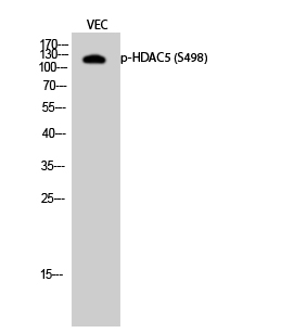Fig.2. Western Blot analysis of VEC cells using Phospho-HDAC5 (S498) Polyclonal Antibody diluted at 1:500.
