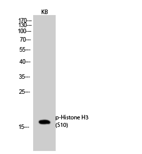 Fig.2. Western Blot analysis of KB cells using Phospho-Histone H3 (S10) Polyclonal Antibody.