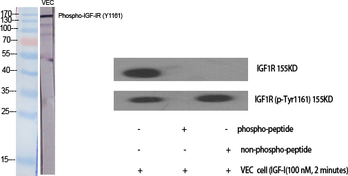 Fig.1. Western Blot analysis of various cells using Phospho-IGF-IR (Y1161) Polyclonal Antibody diluted at 1:2000.