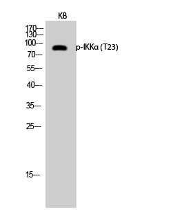 Fig.2. Western Blot analysis of KB cells using Phospho-IKKα (T23) Polyclonal Antibody diluted at 1:1000.