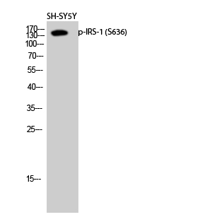 Fig.2. Western Blot analysis of SH-SY5Y cells using Phospho-IRS-1 (S636) Polyclonal Antibody diluted at 1:2000.