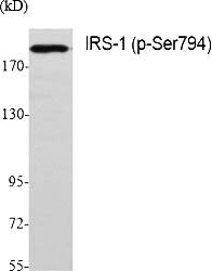 Fig.1. Western Blot analysis of various cells using Phospho-IRS-1 (S794) Polyclonal Antibody diluted at 1:500.