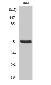 Fig. Western Blot analysis of various cells using Phospho-IκB-β (S23) Polyclonal Antibody.