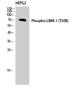 Fig.3. Western Blot analysis of HEPG2 using Phospho-LIMK-1 (T508) Polyclonal Antibody. Antibody was diluted at 1:1000.