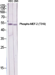 Fig.1. Western Blot analysis of various cells using Phospho-MEF-2 (T319) Polyclonal Antibody diluted at 1:2000.