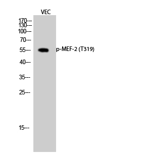 Fig.2. Western Blot analysis of VEC cells using Phospho-MEF-2 (T319) Polyclonal Antibody diluted at 1:2000.
