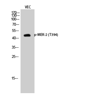 Fig.2. Western Blot analysis of VEC cells using Phospho-MEK-2 (T394) Polyclonal Antibody diluted at 1:2000.