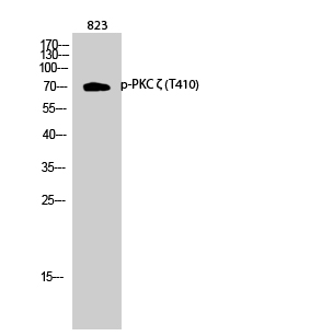 Fig.2. Western Blot analysis of 823 cells using Phospho-PKC ζ (T410) Polyclonal Antibody diluted at 1:1000.