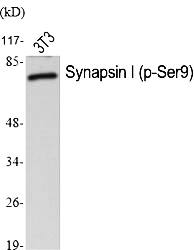 Fig.1. Western Blot analysis of various cells using Phospho-Synapsin I (S9) Polyclonal Antibody diluted at 1:1000.
