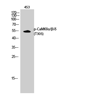 Fig.2. Western Blot analysis of 453 cells using Phospho-CaMKIIα/β/δ (T305) Polyclonal Antibody diluted at 1:1000.