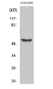 Fig. Western Blot analysis of various cells using Phospho-p53 (S37) Polyclonal Antibody diluted at 1:1000.