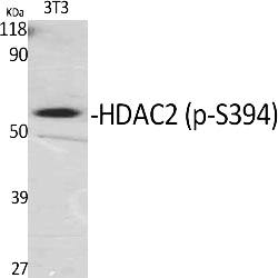 Fig.1. Western Blot analysis of various cells using Phospho-HDAC2 (S394) Polyclonal Antibody.