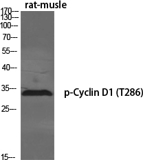 Fig.1. Western Blot analysis of various cells using Phospho-Cyclin D1  (T286) Polyclonal Antibody diluted at 1:500.