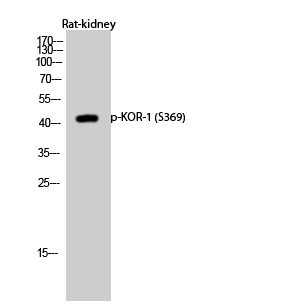 Fig.2. Western Blot analysis of Rat-kidney cells using Phospho-KOR-1 (S369) Polyclonal Antibody diluted at 1:1000.