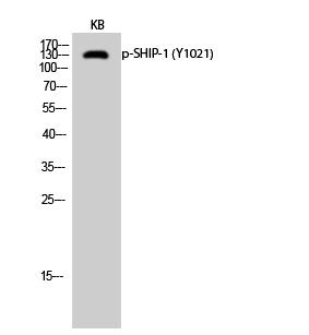 Fig.2. Western Blot analysis of KB cells using Phospho-SHIP-1 (Y1021) Polyclonal Antibody diluted at 1:500.