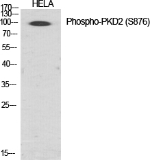 Fig.1. Western Blot analysis of various cells using Phospho-PKD2 (S876) Polyclonal Antibody diluted at 1:1000.