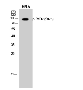 Fig.2. Western Blot analysis of HELA cells using Phospho-PKD2 (S876) Polyclonal Antibody diluted at 1:1000.