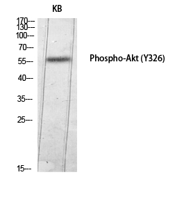 Fig.3. Western Blot analysis of KB using Phospho-Akt (Y326) Polyclonal Antibody diluted at 1:1000.