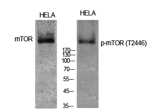 Fig. Western Blot analysis of various cells using Phospho-mTOR (T2446) Polyclonal Antibody diluted at 1:1000.