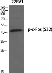 Fig. Western Blot analysis of various cells using Phospho-c-Fos (S32) Polyclonal Antibody diluted at 1:500.