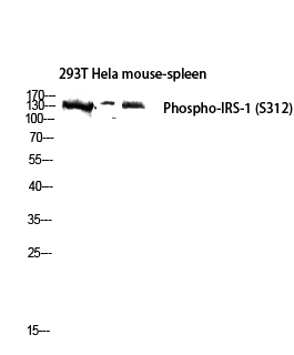 Fig.2. Western blot analysis of 293T Hela mouse-spleen lysis using Phospho-IRS-1 (S312) antibody. Antibody was diluted at 1:1000.