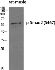 Fig.1. Western Blot analysis of various cells using Phospho-Smad2 (S467) Polyclonal Antibody diluted at 1:500.