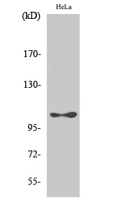Fig. Western Blot analysis of various cells using Phospho-eEF2K (S366) Polyclonal Antibody diluted at 1:1000.