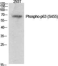 Fig.1. Western Blot analysis of various cells using Phospho-p63 (S455) Polyclonal Antibody diluted at 1:1000.