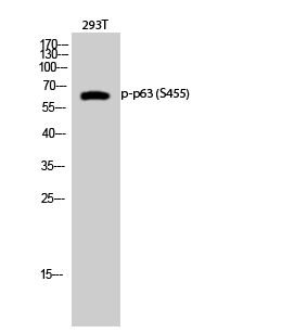 Fig.2. Western Blot analysis of 293T cells using Phospho-p63 (S455) Polyclonal Antibody diluted at 1:1000.