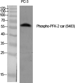 Fig.1. Western Blot analysis of various cells using Phospho-PFK-2 car (S483) Polyclonal Antibody diluted at 1:1000.