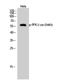 Fig.2. Western Blot analysis of Hela cells using Phospho-PFK-2 car (S483) Polyclonal Antibody diluted at 1:1000.