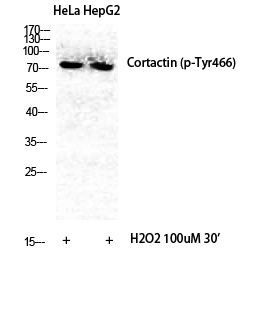Fig.1. Western Blot analysis of various cells using Phospho-Cortactin (Y466) Polyclonal Antibody diluted at 1:500.