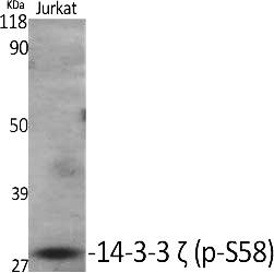 Fig.1. Western Blot analysis of various cells using Phospho-14-3-3 ζ (S58) Polyclonal Antibody diluted at 1:2000.
